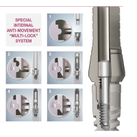 Abutments